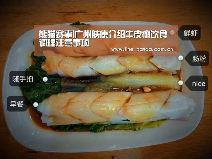 熊猫赛事|广州肤康介绍牛皮癣饮食调理注意事项(图1) 熊猫体育平台